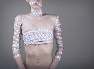 Persona con el torso envuelto en una cinta métrica, imagen sobre la anorexia y su tratamiento psicológico